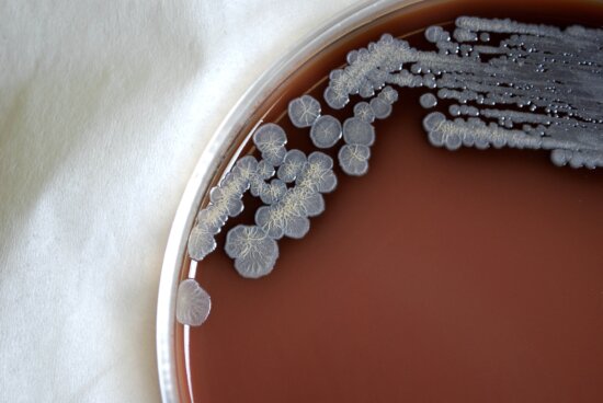 colonial, morphology, gram, negative, burkholderia pseudomallei, bacteria