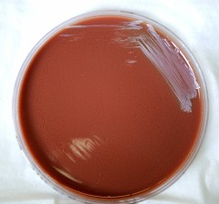 Free Picture: Gram, Negative, Burkholderia Pseudomallei, Bacteria ...