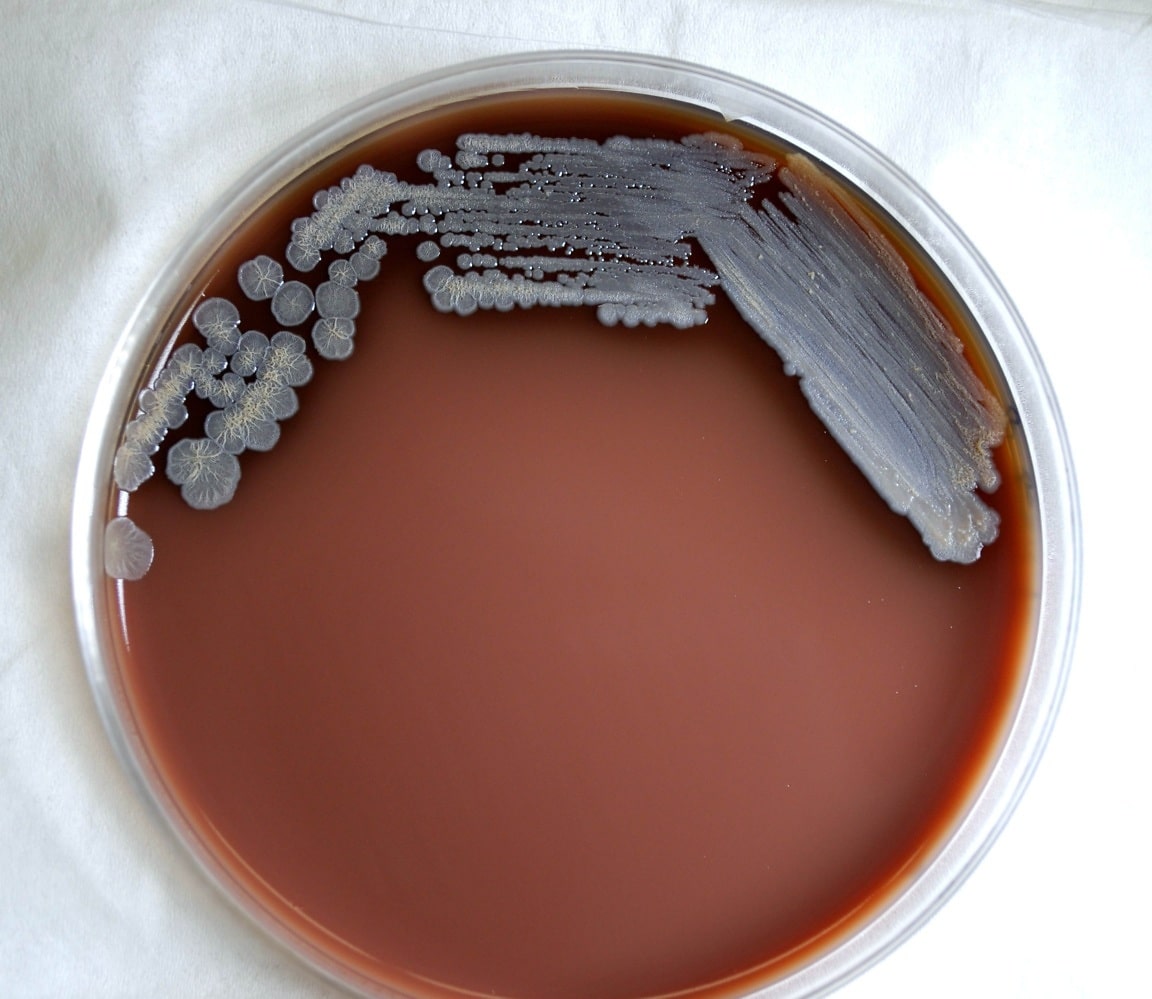 Free Picture: Gram, Negative, Burkholderia Pseudomallei, Bacteria