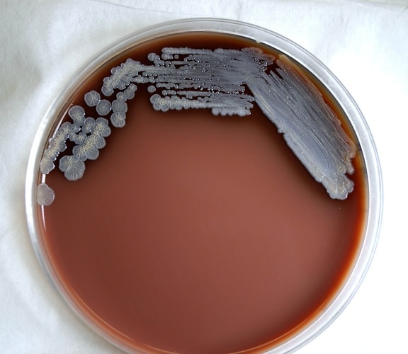 그램, 네거티브, burkholderia pseudomallei, 박테리아