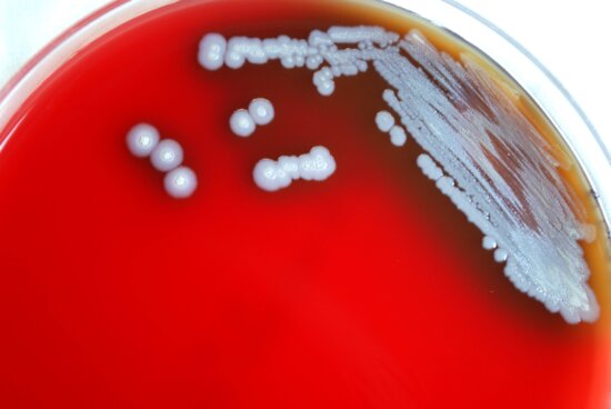 gram, negative, burkholderia pseudomallei, bacteria, grown, blood agar