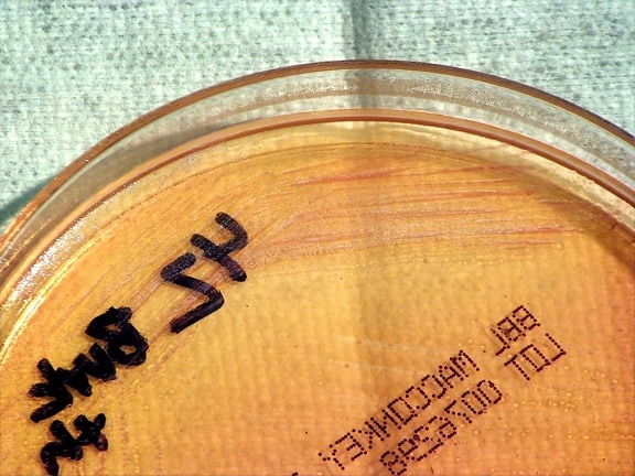 gram negativna, bakterije burkholderia thailandensis, bakterije, narasla, macconkey, agar