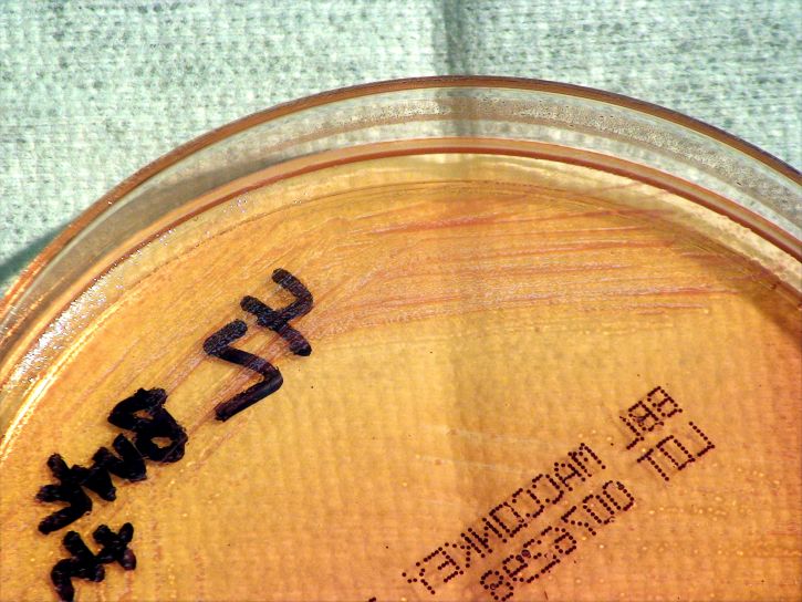 Gram negativní, burkholderia thailandensis, bakterie, pěstované, krevním, agar