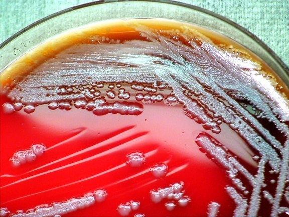 gram, negative, burkholderia thailandensis, bacteria, grown, blood agar