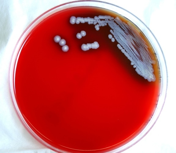 melioidosis, Whitmoreovom, bolesti, zarazne bolesti, bakterija, bakterije burkholderia pseudomallei