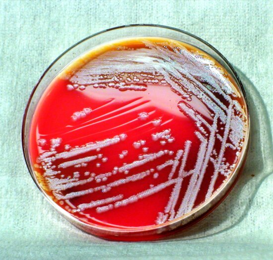 Free Picture: Burkholderia Thailandensis, Bacteria, Grown, Blood Agar