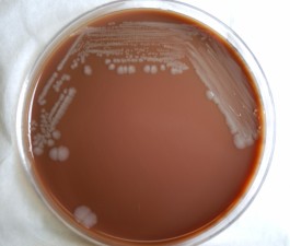 Free Picture: Gram, Negative, Burkholderia Pseudomallei, Bacteria ...