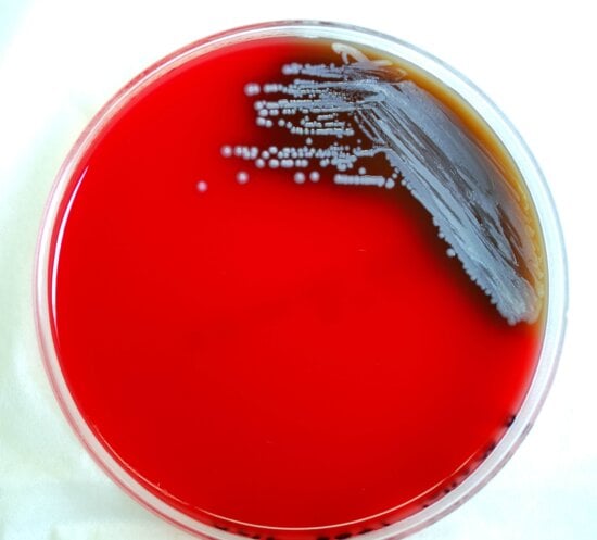 Free Picture: Gram, Negative, Burkholderia Pseudomallei, Bacteria ...