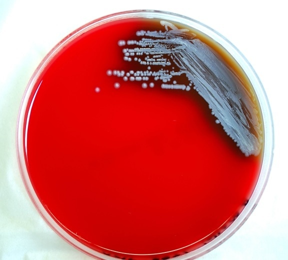 Whitmoreovom, bolesti, zarazne bolesti, bakterija, bakterije burkholderia pseudomallei