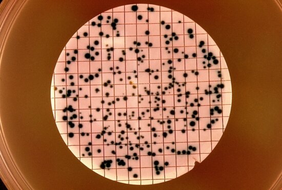 neisseria gonorrhoeae culture