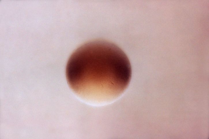 ขยาย ชนิด ห้องปฏิบัติ การ ปลูก neisseria gonorrhoeae แบคทีเรีย อาณานิคม