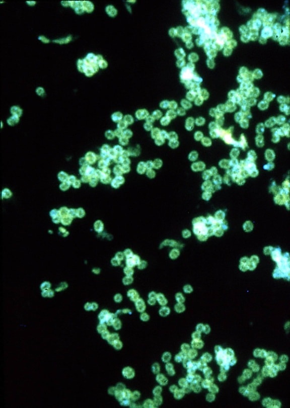 fluorescerende antistoff mikroskop-bilde, positiv, resultat, testing, tilstedeværelse, gonoré
