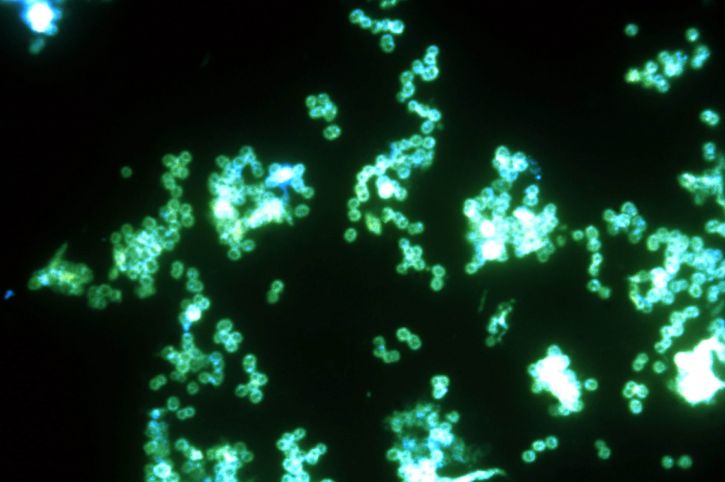 fluorescerende antistoff tester, gram, negative, bakterier, neisseria gonorrhoeae