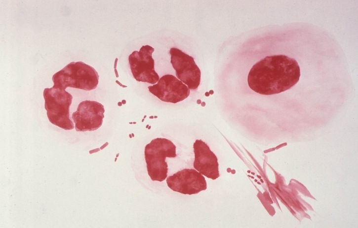 gonococci, lokalizované, infekcie pohlavných