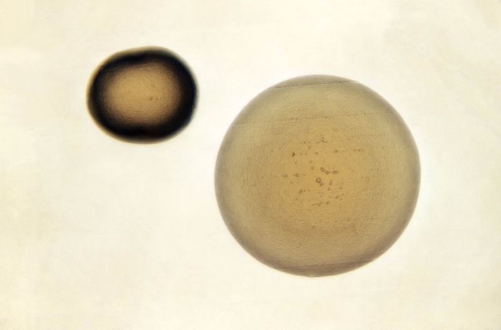 neisseria gonorrhoeae, colonies, grown, period, media, base, agar
