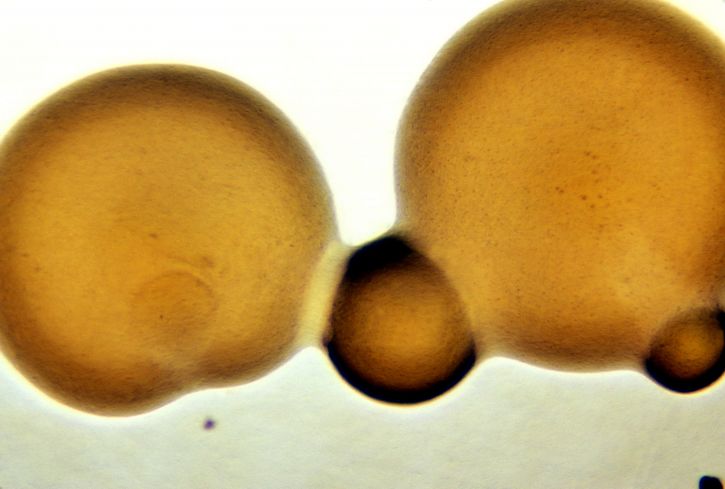 Neisseria, gonorrhoeae, koloni, tumbuh, dasar, media, isovitalex