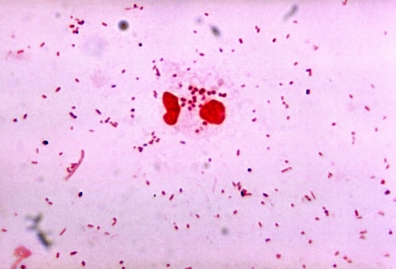 gonorrhoeae грам негативні, diplococcus, причинні, агент, гонорея