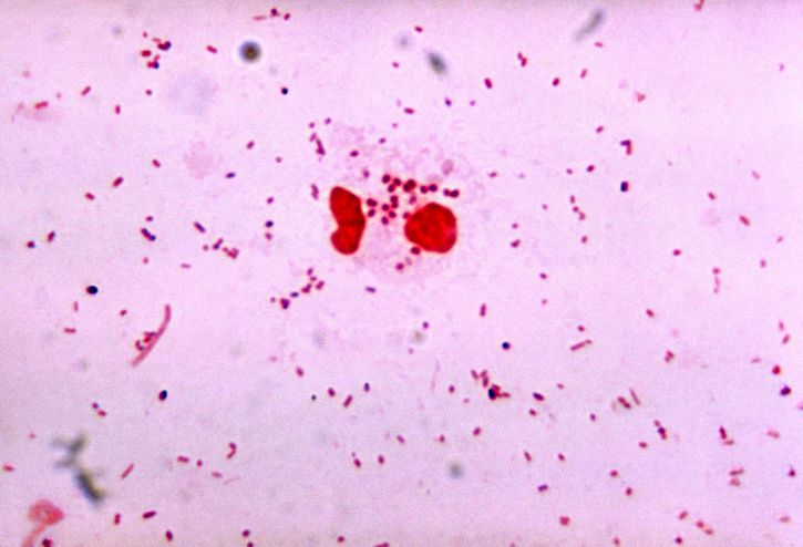 gonorrhoeae กรัม ลบ diplococcus สาเหตุ ตัวแทน หนองในแท้