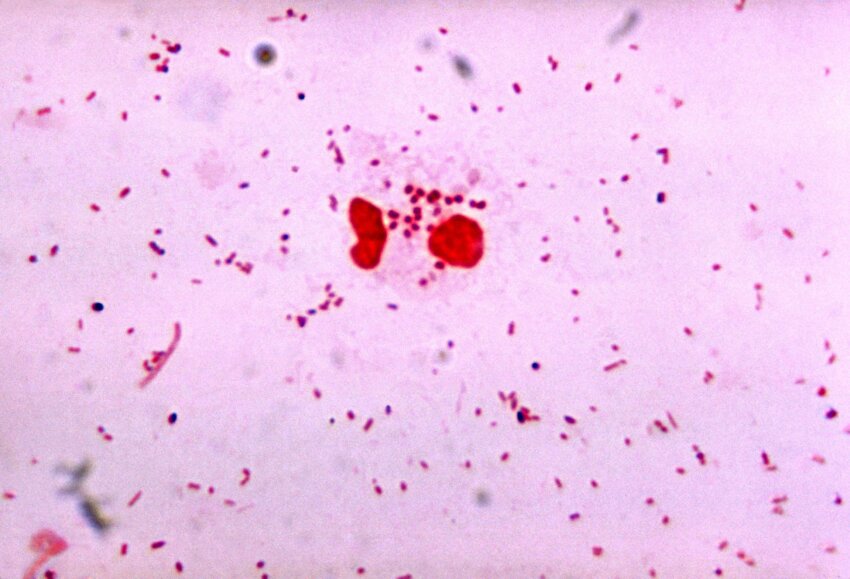 Imagen Gratis Gonorrhoeae Gramo Negativo Diplococcus Causal Agente La Gonorrea
