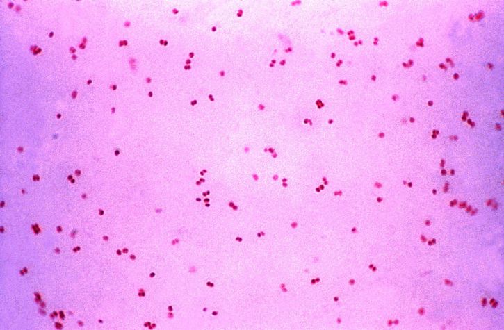 microphotographie, gram, négatif, bactéries, Neisseria, gonorrhoeae