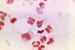 Free picture: gram, negative, neisseria, gonorrhea, bacteria, paired ...