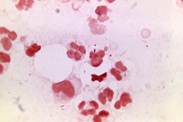 gekleurd, bacteriën, studie, patiënt, niet-specifieke, urethritis, vergroot, 1125 x