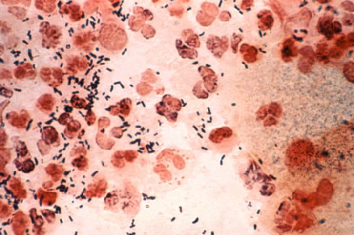 микроснимка ректално, Намажете разкриване, neisseria gonorrhoeae