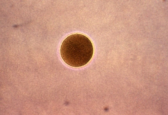 microphotographie, colonie, Neisseria, gonorrhoeae