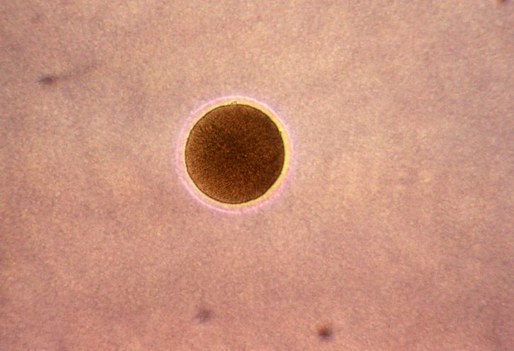 Микрофотография, колонии, neisseria gonorrhoeae