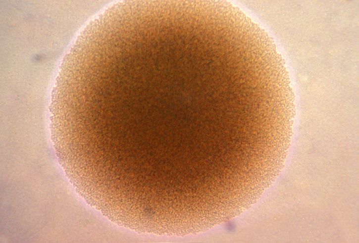 photomicrograph колонії neisseria gonorrhoeae, бактерії, лабораторії, мікроскоп