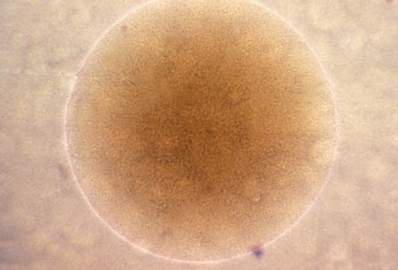 microfotografía, colonia, Neisseria, gonorrhoeae, bacterias, células, magnificado, 100x