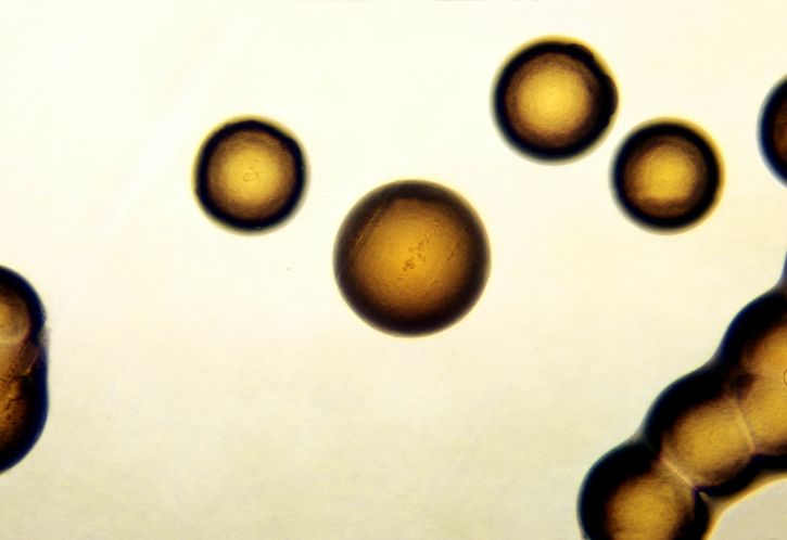 Mikrophotographie, Neisseria, gonorrhoeae, Kolonien