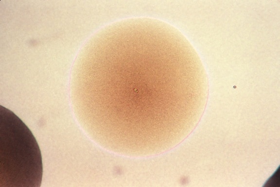 colony, neisseria gonorrhoeae, bacteria