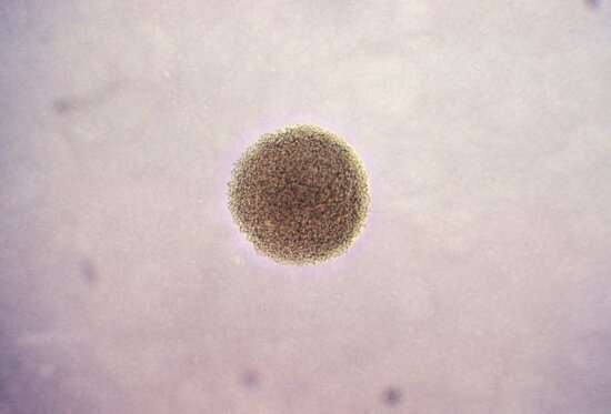 photomicrograph, colonie, neisseria gonorrhoeae, bacterii, amplificată, 100 x