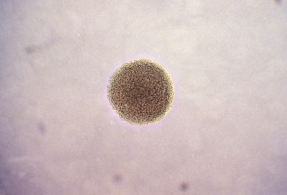 microfotografía, colonia, Neisseria, gonorrhoeae, bacterias, magnificado, 100x
