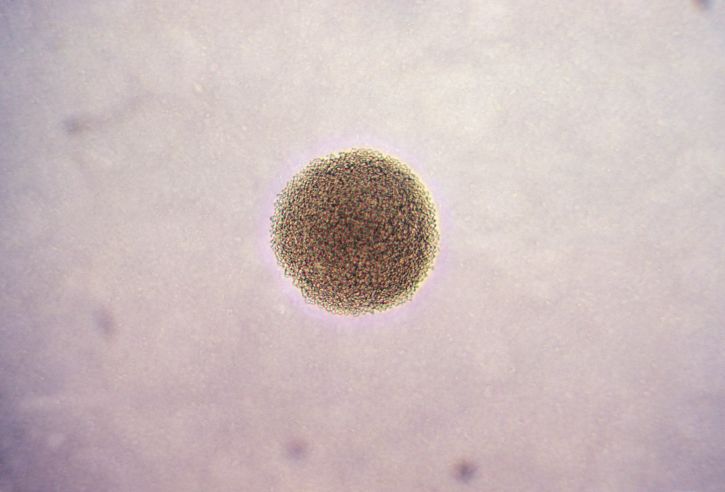 φωτομικρογράφο, αποικία, neisseria gonorrhoeae, βακτήρια, μεγεθύνονται, 100 x