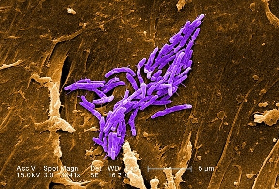 gram, positive, bacilli, mycobacteria fortuitum, bacteria