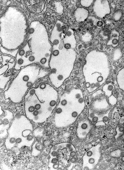 elektron mikroskop-bilde rift valley, feber, virus