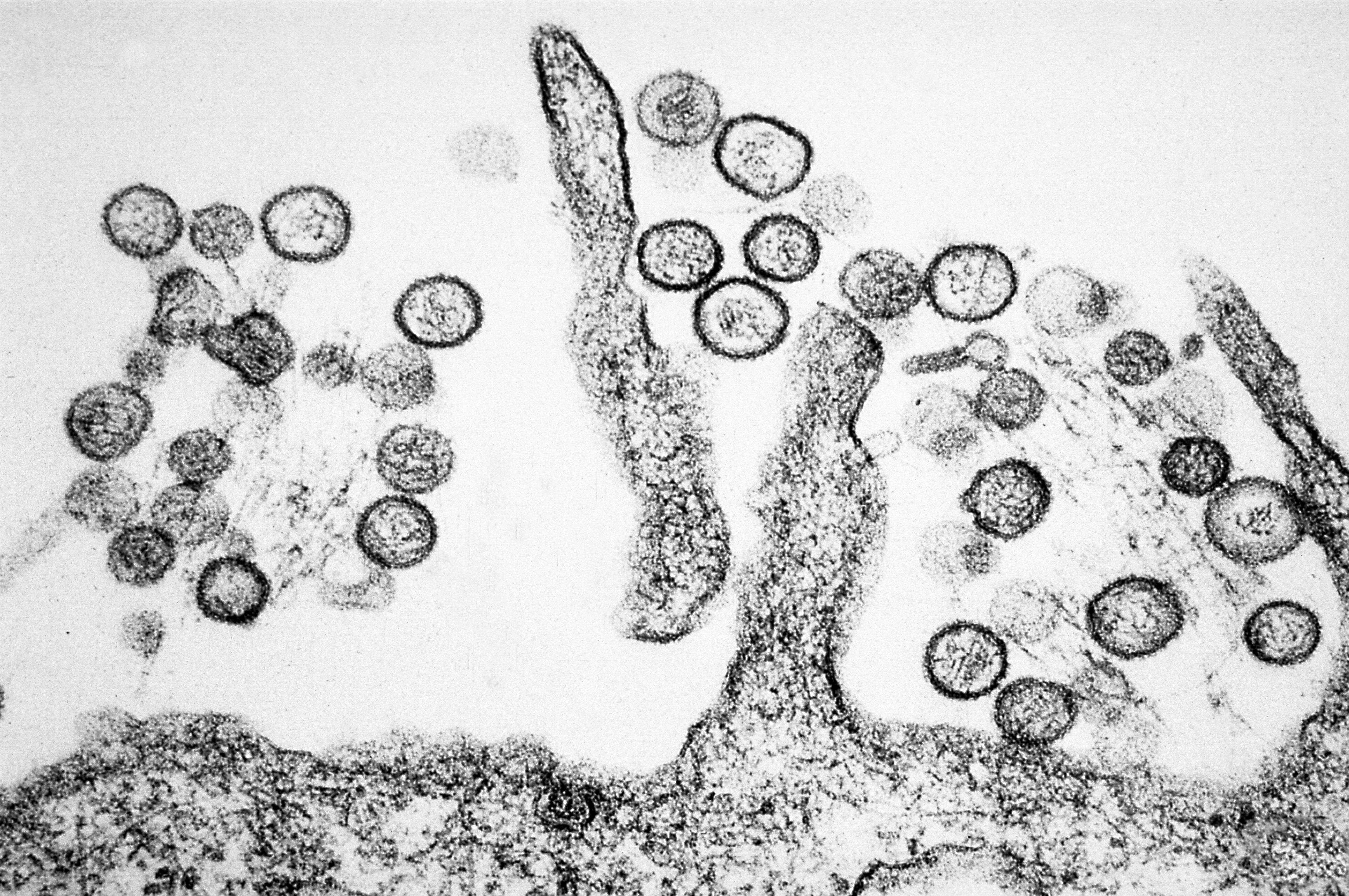 免费照片 汉坦病毒 病毒 肺 综合征 携带 啮齿动物 粪便