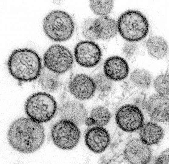 전송 전자 현미경 사진, 죄, 이름, 바이러스, hantavirus