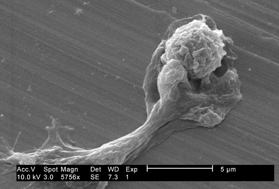 amoebae, předpokládal, zkreslený tvar, protlačované za tepla, Panožka (améba)