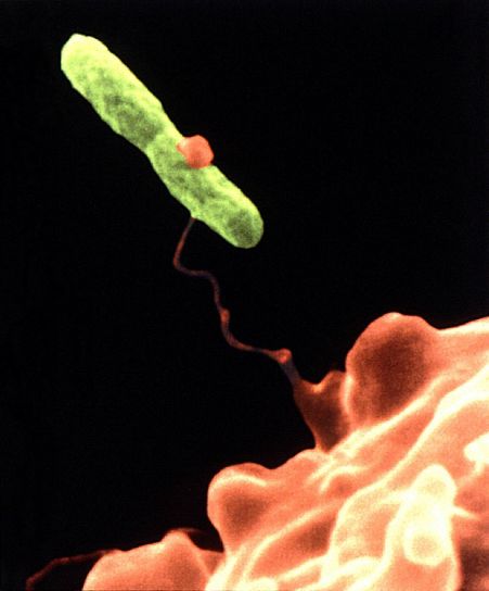 Hartmannella, vermiformis, arancio, intrappola, Legionella pneumophila,, batteri, verde