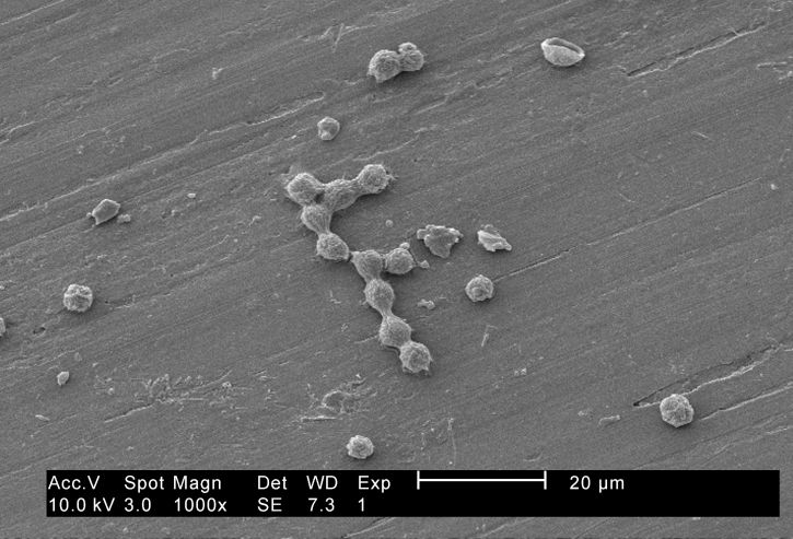 legionella pneumophila,, batteri, colonizzare, crescere, biofilm, vermiformis