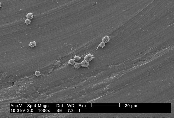 สำคัญ เวที จุลินทรีย์ amoebas ชีวิต วงจร ถุง