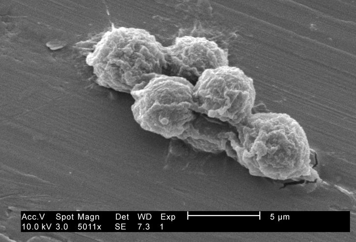 ศึกษาลักษณะชนิด สัณฐานวิทยา จัดแสดง ขนาดเล็ก จัดกลุ่ม hartmannella vermiformis, amoebae, trophozoites