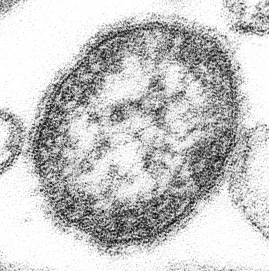 la rougeole, virus, paramyxovirus, genre, morbillivirus