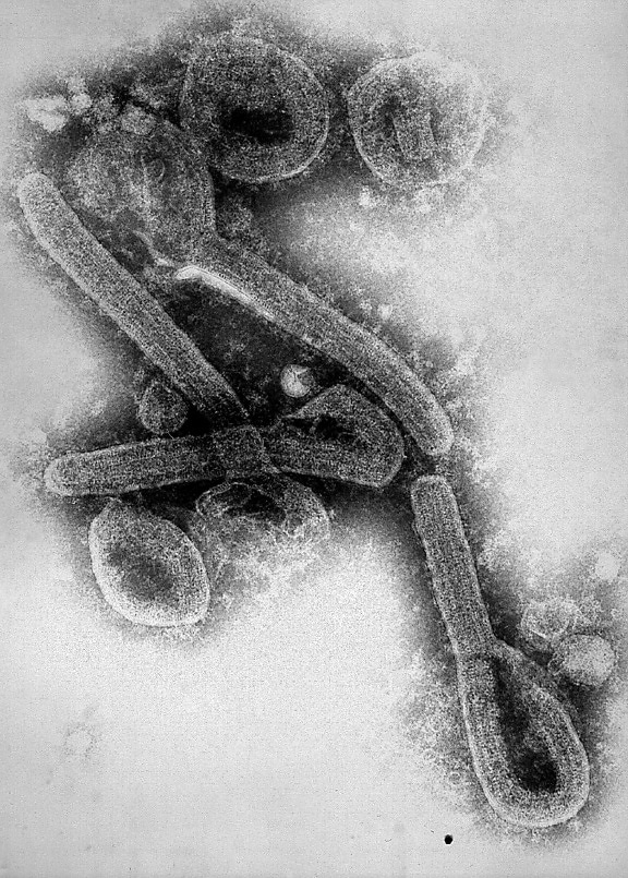 micrografía, Marburg, virus, severa, el tipo hemorrágico, fiebre