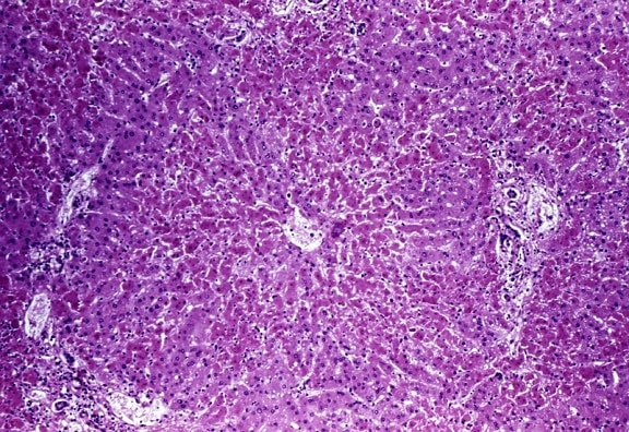 photomicrograph, cytoarchitectural, histopathologic, detected, liver