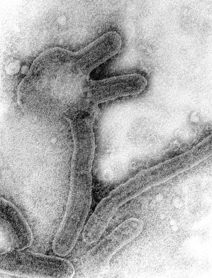 негативних, передачі електронна мікрофотографія Марбурга, вірус, virions
