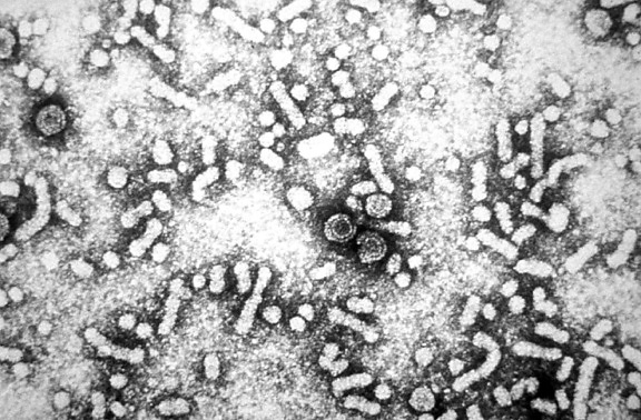 Електронна мікрофотографія присутність Гепатит, вірус, Дейн, часток, virions